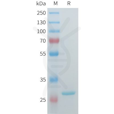 sp-pme101554 hsd17b10 sp1