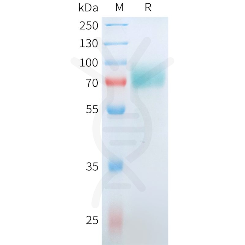 Human CD19(M75V,R76S,F85S) Protein, hFc Tag - 专注肿瘤免疫