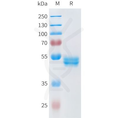 sp-pme101594 ror2 sp1