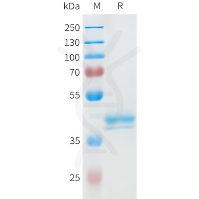 sp-pme101595 ror2 sp1