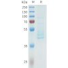 sp-pme101613 cdh3 sp1