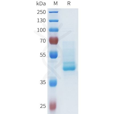 sp-pme101631 cdh1 sp1