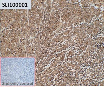 ihc-sli100001 rpmi 8226 ihc1